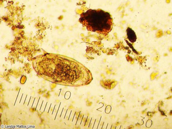 Este é o parasito Schistosoma mansoni, causador da doença Esquistossomose: A infecção é através de água contaminada contendo larvas de hospedeiros caramujos. Nas aulas de parasitologia você vai conhecer esta e outras espécies de helmintos que causam doenças.