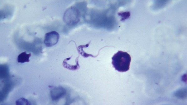 Além disso, você também irá estudar alguns protozoários causadores de doenças, como o Trypanossoma cruzi, causador da doença de chagas.
